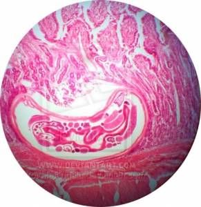 Ancylostoma_perro