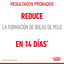 85 g Royal Canin Hairball Care Sobre en Gelatina para gatos, , large indicador imagen numero 5